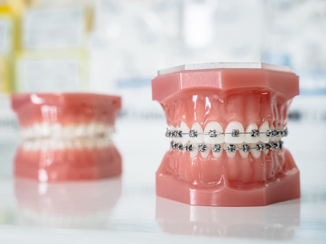 Close-up of teeth with orthodontic braces