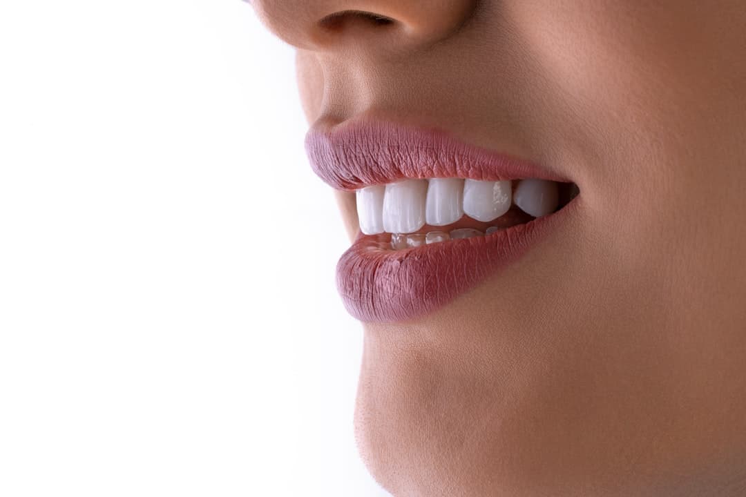 Original smile without braces